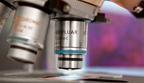 Alzheimer's Disease - Alzheimers Survey Alzheimer's Disease - Alzheimers Survey